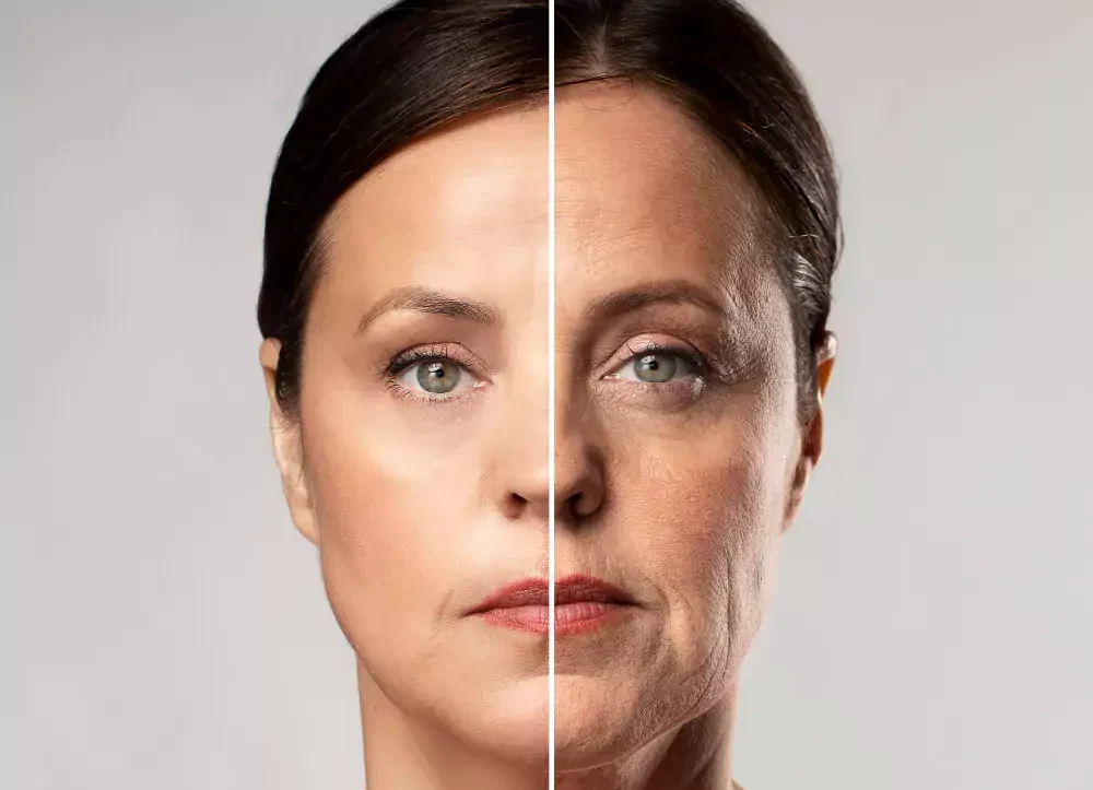 Skin Aging